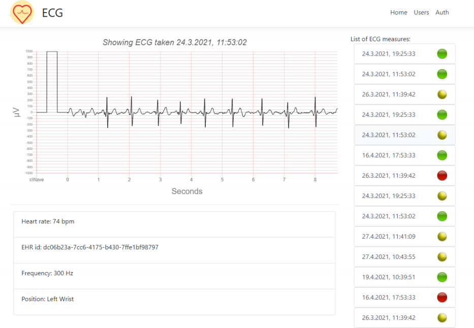 A screenshot of the final web application. The screenshot shows the
interactive ECG visualization, along with all the available ECGs for this
patient on the right hand side. 